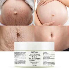 Cellulite & Skin Tightening “Tummy Tuck” Cream Elasticity Belly Stretch Mark