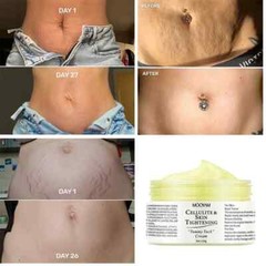 Cellulite & Skin Tightening “Tummy Tuck” Cream Elasticity Belly Stretch Mark